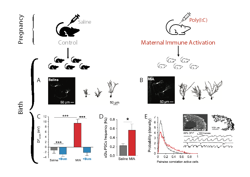 Immune activation during gestation leads to hippocampal neuronal alterations already at birth