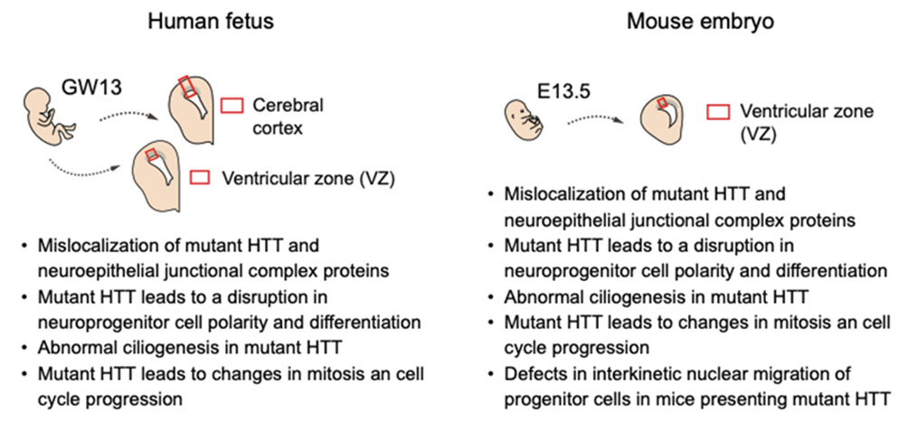 Une étude sur la maladie de Huntington soutenant le concept de neuroarchéologie