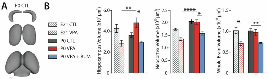 No stop-growing signal around birth in a rodent model of autism